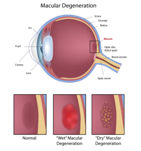 Medical diagram of an eye.